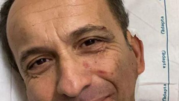Il comico Uccio De Santis in ospedale