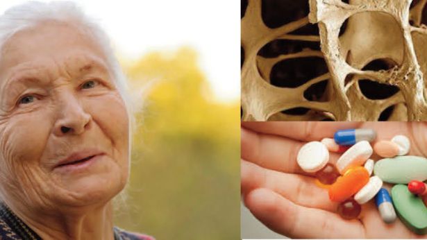 Osteoporosi