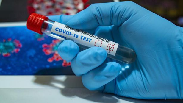 Test coronavirus