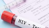 HIV